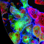 Image Confocal Microscopy